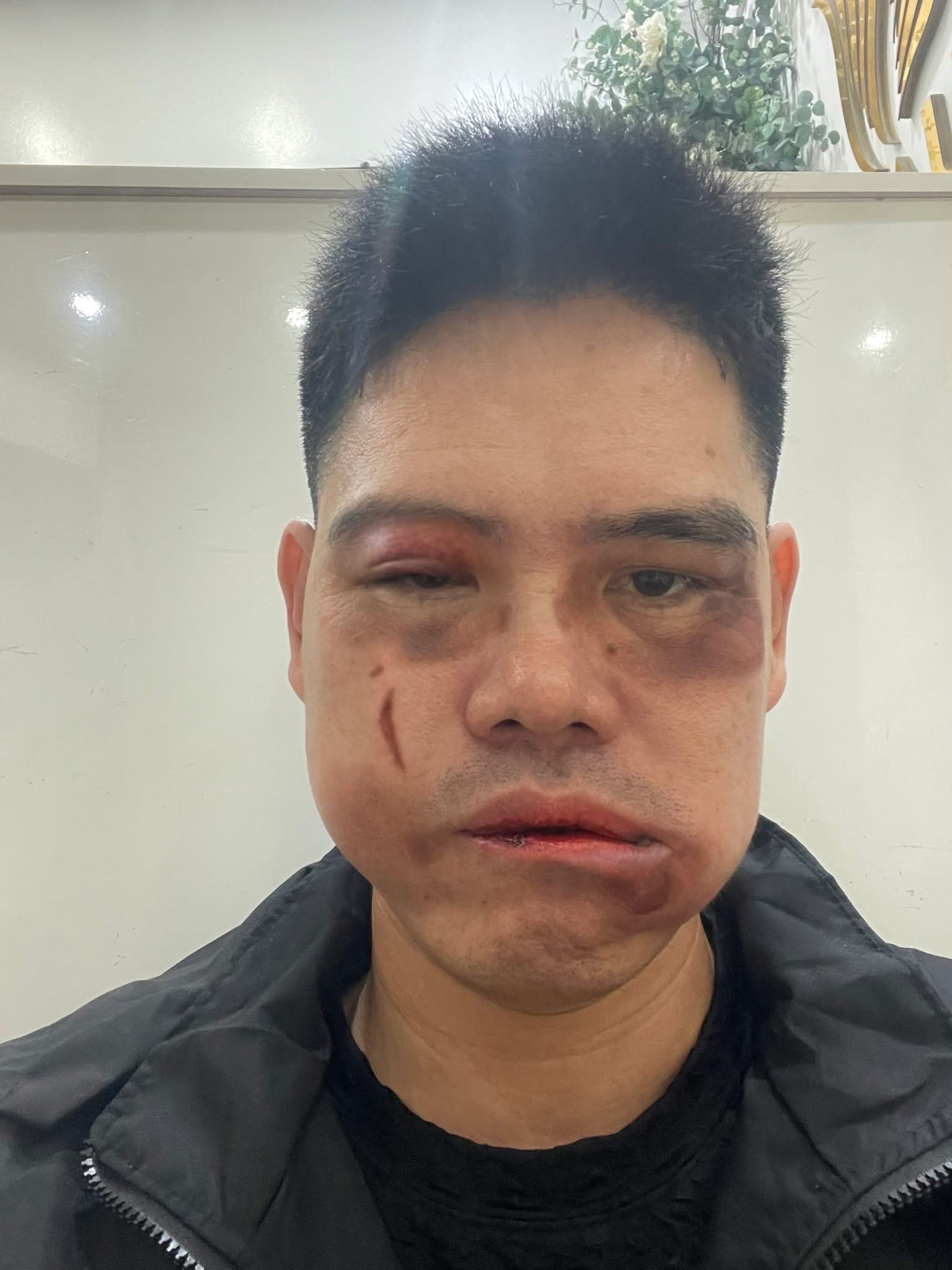 Ảnh thu nhỏ của Ông bố t/ác đ/ộng tài xế tacxi 